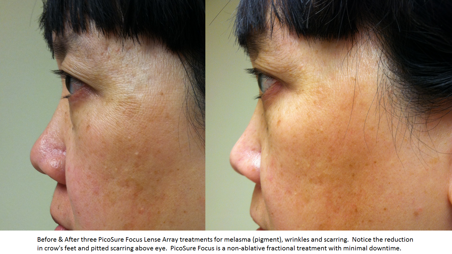 Skin Revitalization *