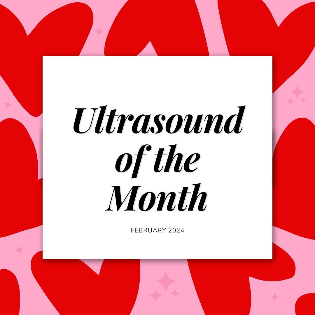 This year, don&rsquo;t send your Valentine (another) echo, send them a picture of a #cuterus like this bicornuate uterus captured on ultrasound by graduating senior resident, @koule_lespwi ! This type of structural abnormality can present with recurr