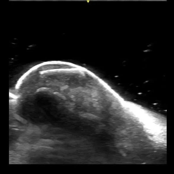 MSK (Soft Tissue)