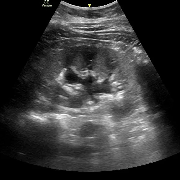 Renal