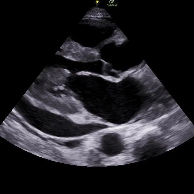 Advanced Echo (Coming Soon!)