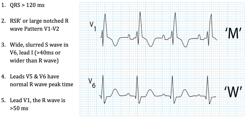 The Heart Of The Matter - A Case of Substernal Chest Pain — Cook County ...
