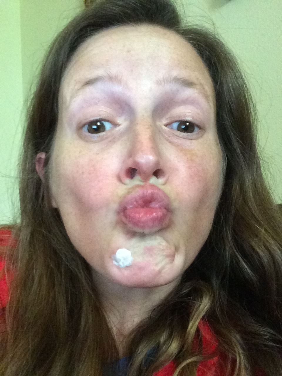 Oh my God! That's a terrifying picture! But, I promised and unfiltered look at my life, didn't I? Well, that's me, isn't it? At this point, I'm all, "Maybe, this constant drying mask will work." Bwahahahaha! I wore that stupid thing almost 24-7 for days and days. Nope