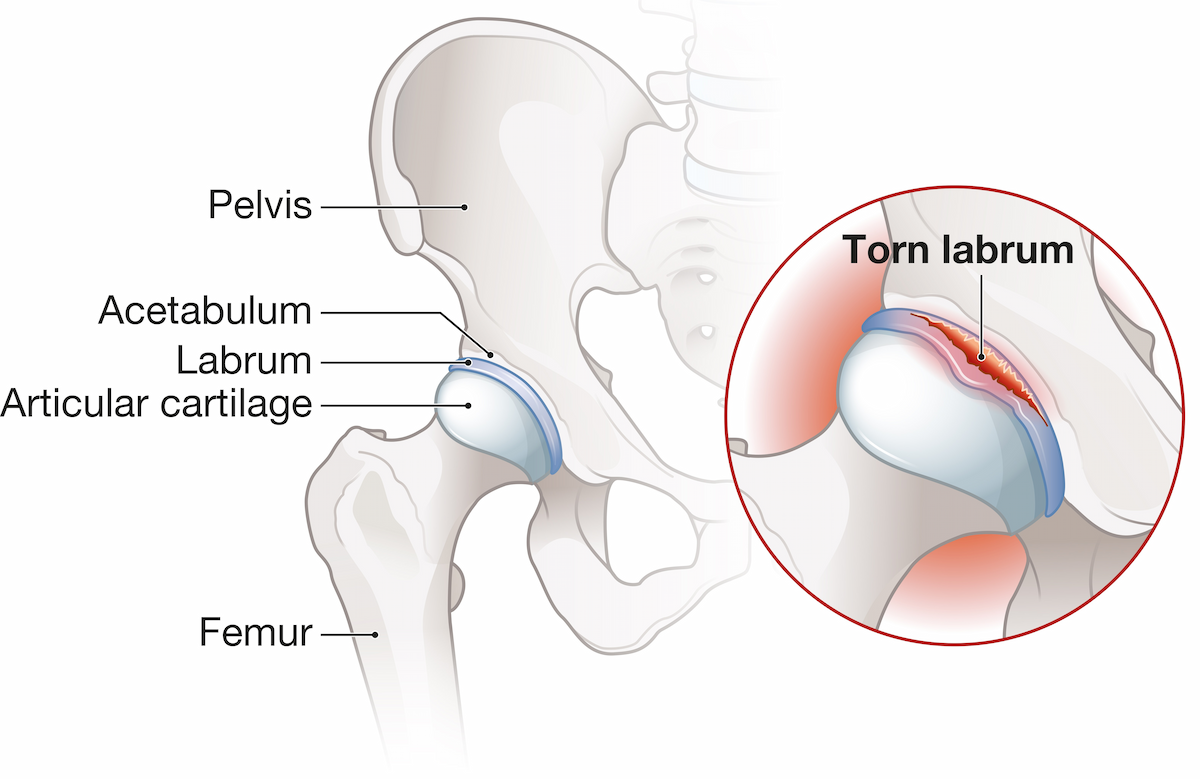 Hip labrum anatomy — the labrum lines the rim of the hip socket