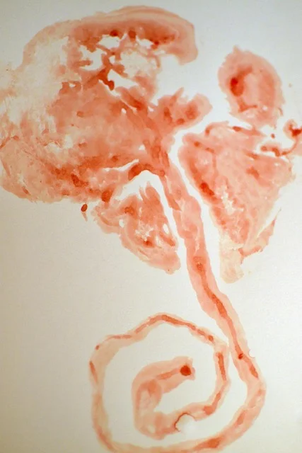 Placenta Add On: Print