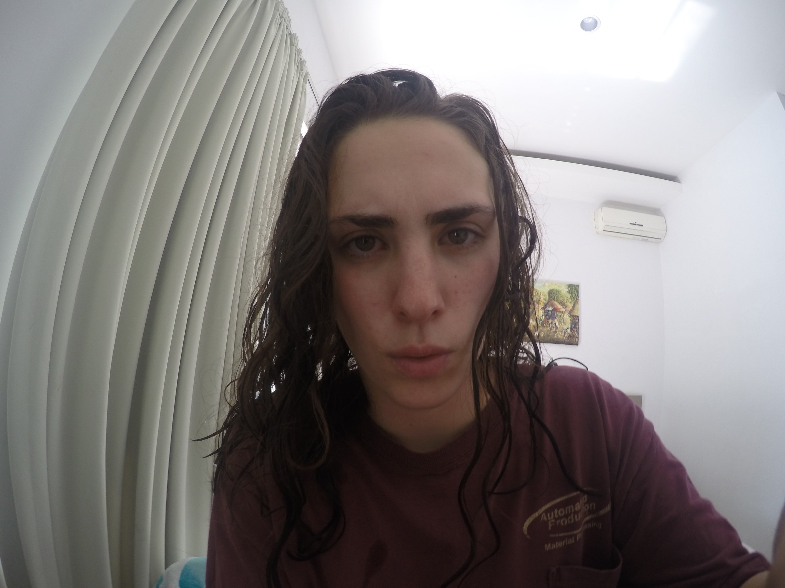 Delusional and blood shot eyes