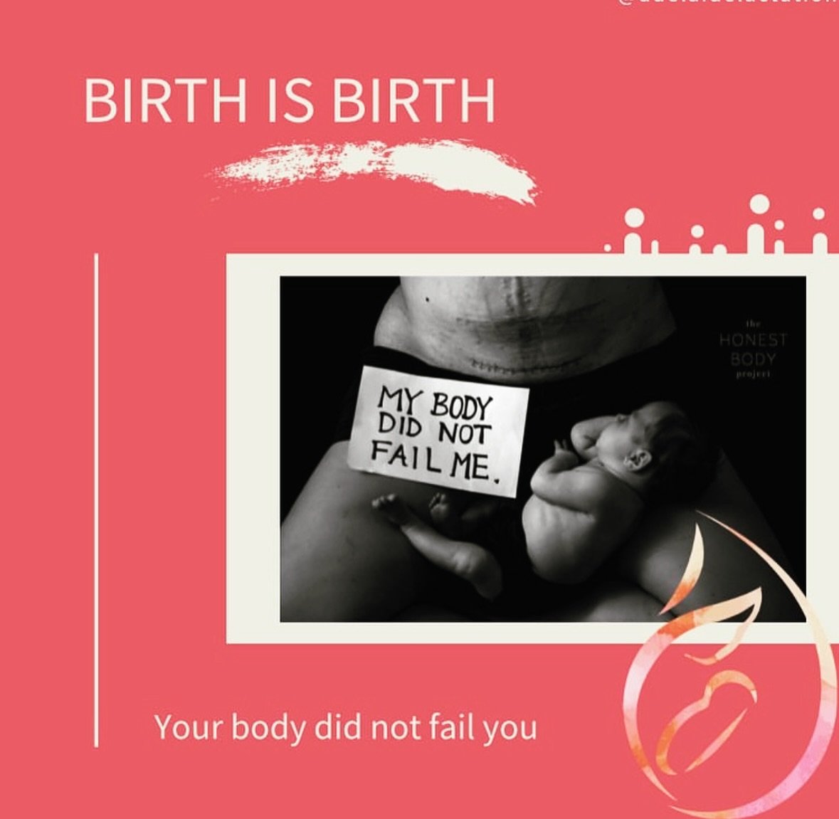 💫 April is Caesarean Awareness Month💫
It took me years to come to terms with my caesarean birth.  I somehow felt like a failure or less of a woman for not being able to birth naturally.
In the end, I laboured really well and easily...... but my bab