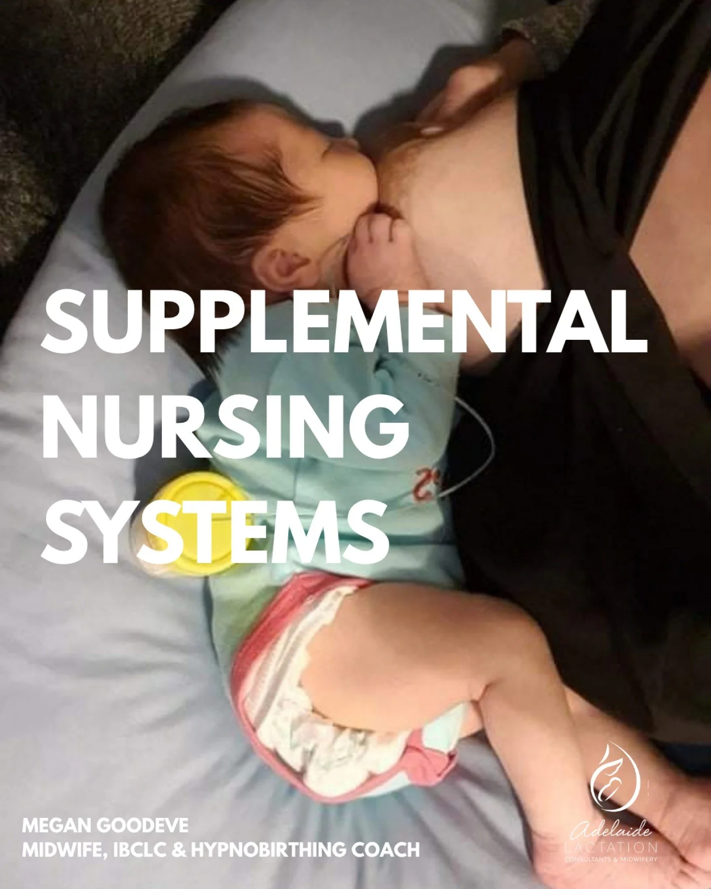 Supply lines or Supplemental Nursing Systems

Sometimes, for whatever reason, babies do not latch/drink well in the first days and weeks after they are born.  Or mum has a condition whereby she cannot make an full milk supply.

If baby doesn't drink 