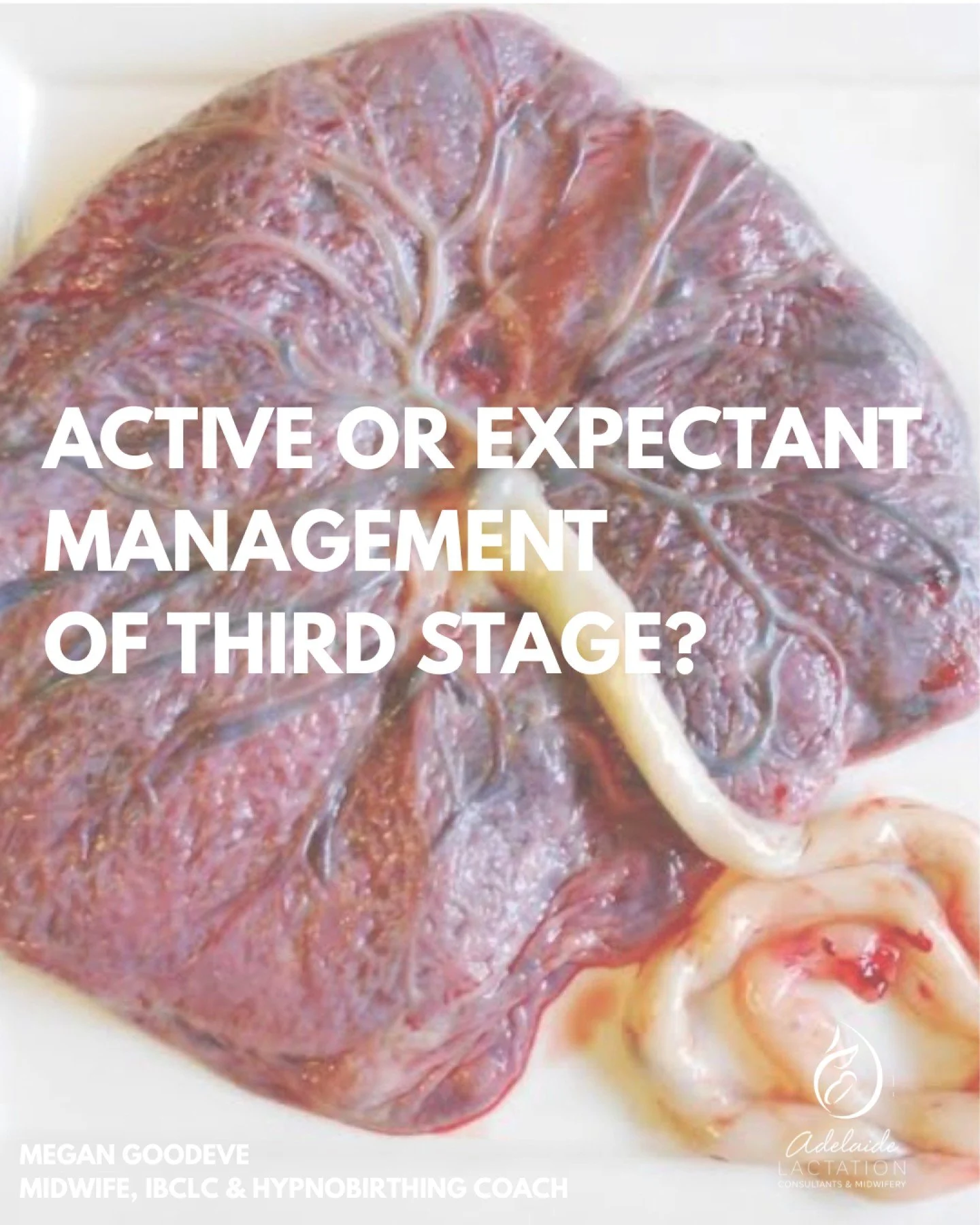 ACTIVE MANAGEMENT�
This is the routine approach used in most Australian hospitals. 
It usually involves:�
&bull; An injection of a uterotonic medication after birth (commonly Syntometrine or Carbetocin)�
&bull; Controlled cord traction (guided delive