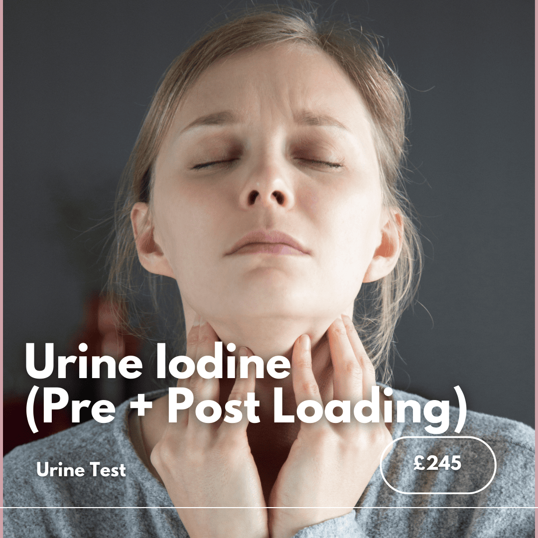 Iodine Urine Test.png