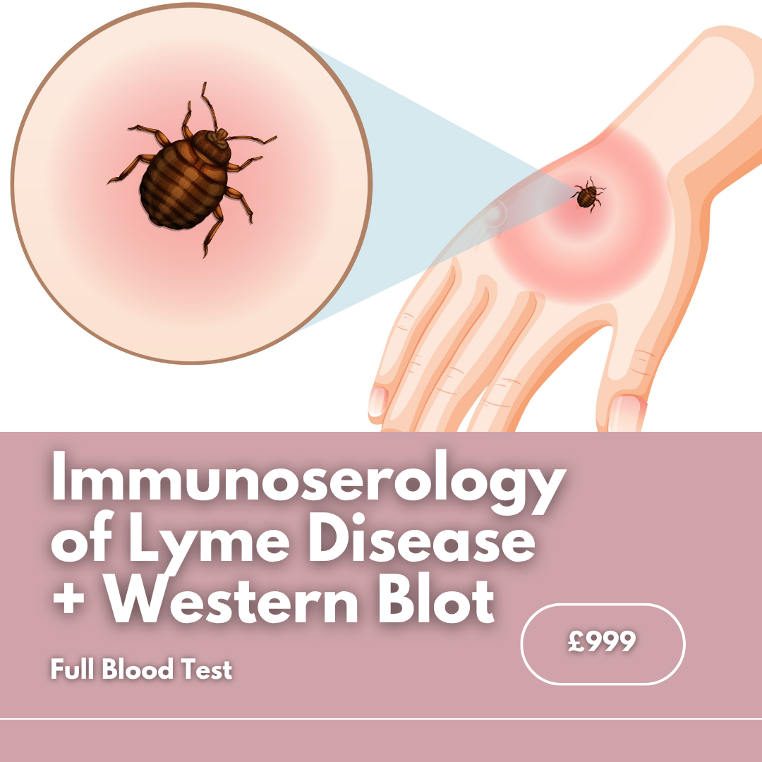 Immunoserology of Lyme Disease + Western Blot - Blood Test.png