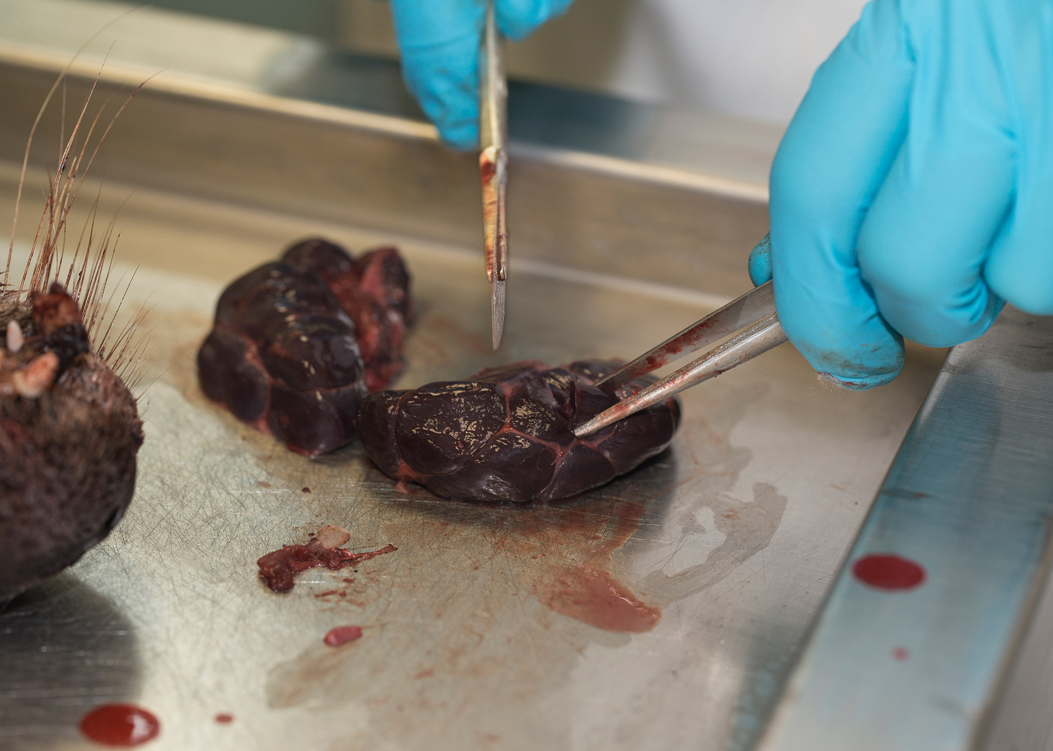 The Kidneys