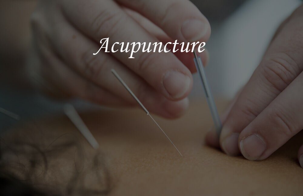 Acupuncture-min.jpg