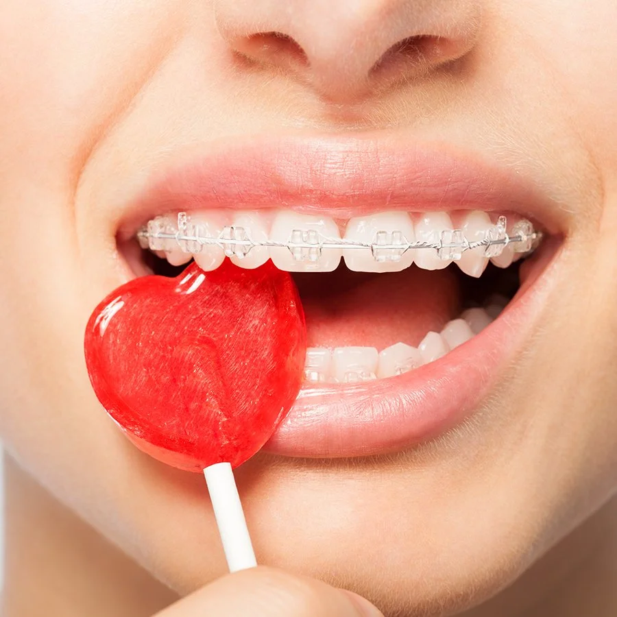 What foods should I avoid while I'm wearing braces?