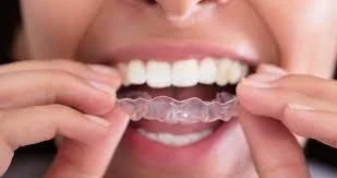 Will my teeth shift if I don't wear my retainers?