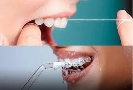 String floss vs. water flosser, which is better?