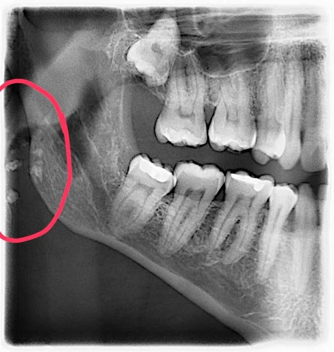 Did You Know Your Dental Checkup Could Save Your Life? Unveiling the Secrets Hidden in Your Smile!