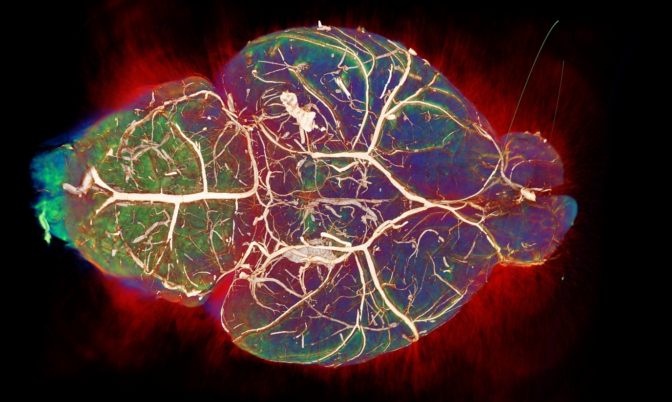 OPT of blood vessels in the brain