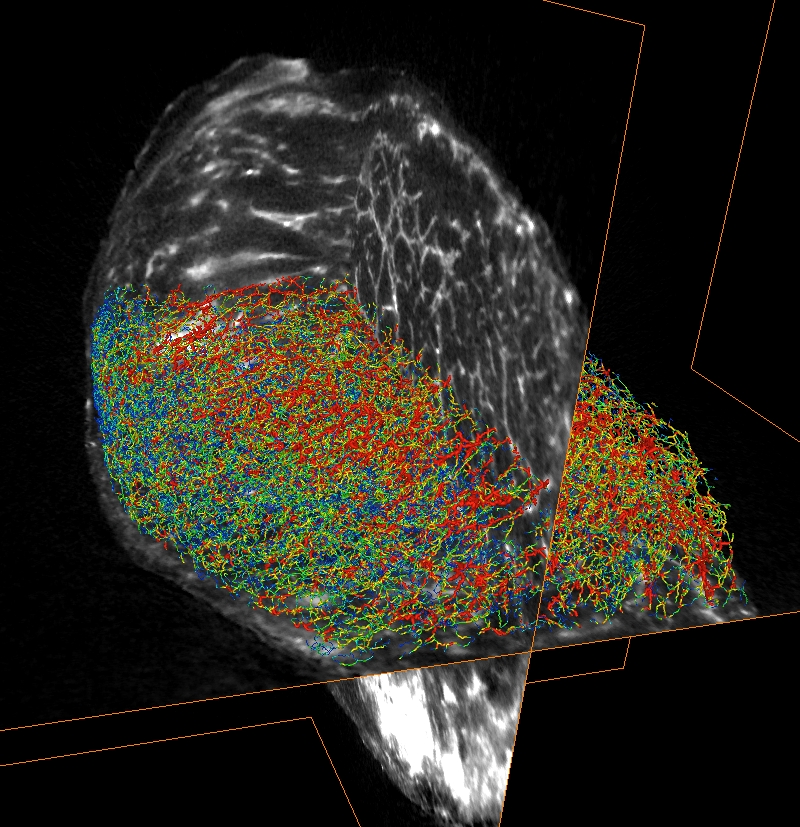 OPT image of tumour blood vessels