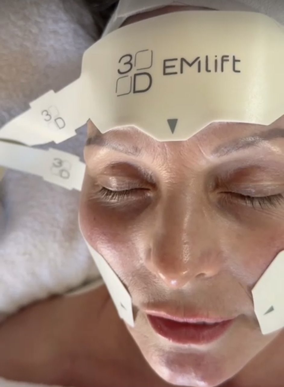 20% off EMlift with Elizabeth M - voted Edinburgh's leading facialist