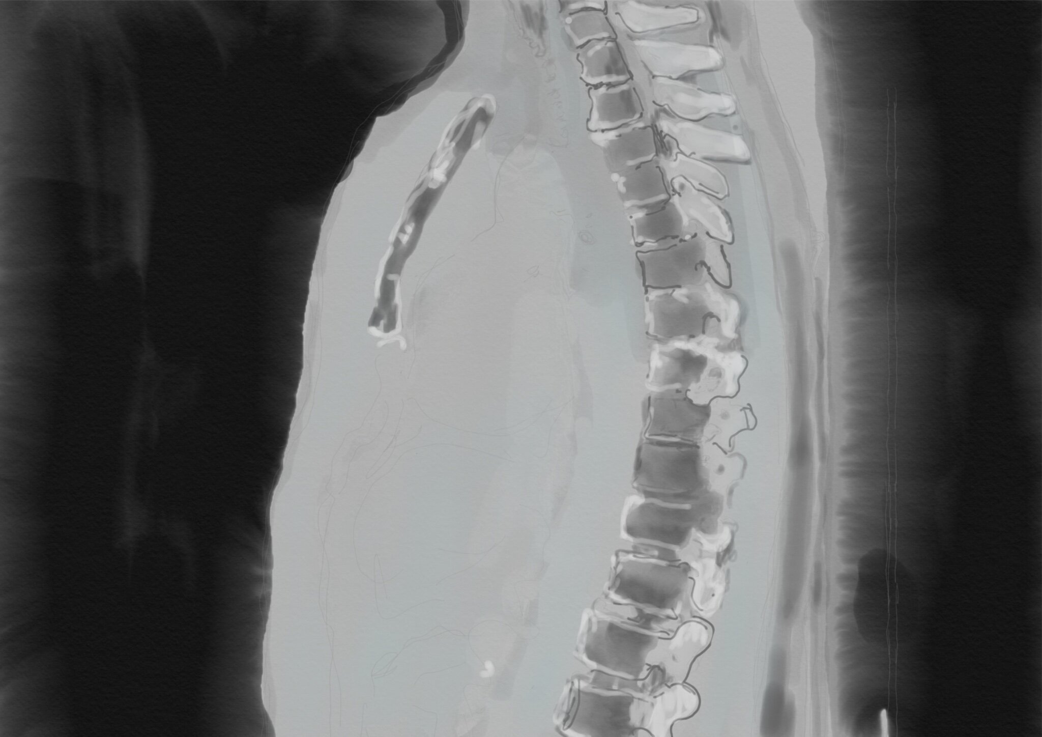 The Trembling, a love letter to my spine