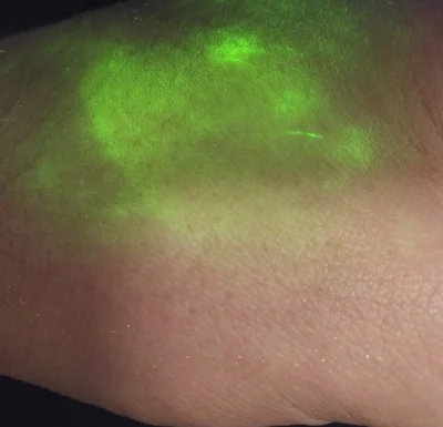 Detection of a thumb print on skin.