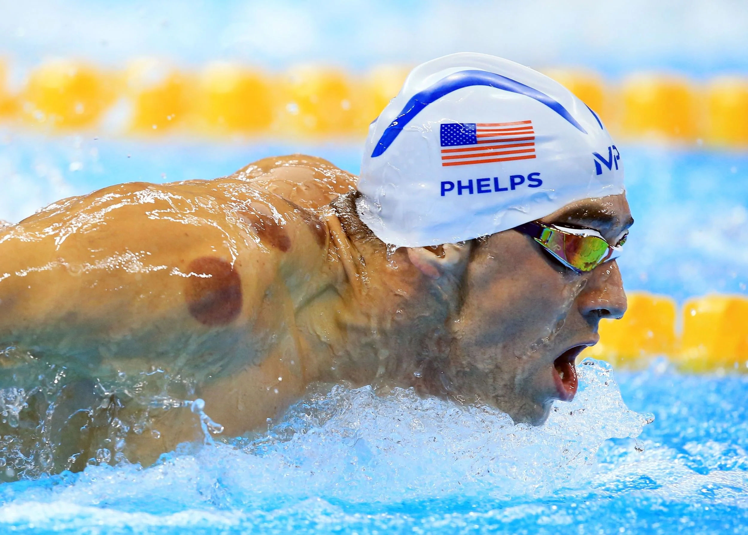 Image courtesy of Getty images