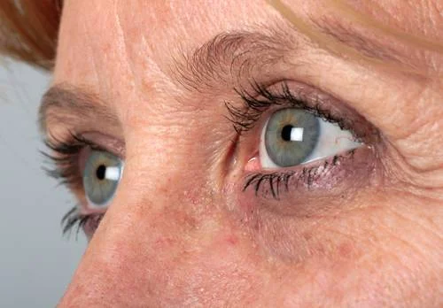 Defeating Aging – More than Just Sun Screen, Botox and Moisturizer