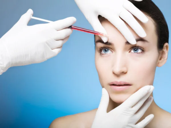 What IS A Vampire Facelift?