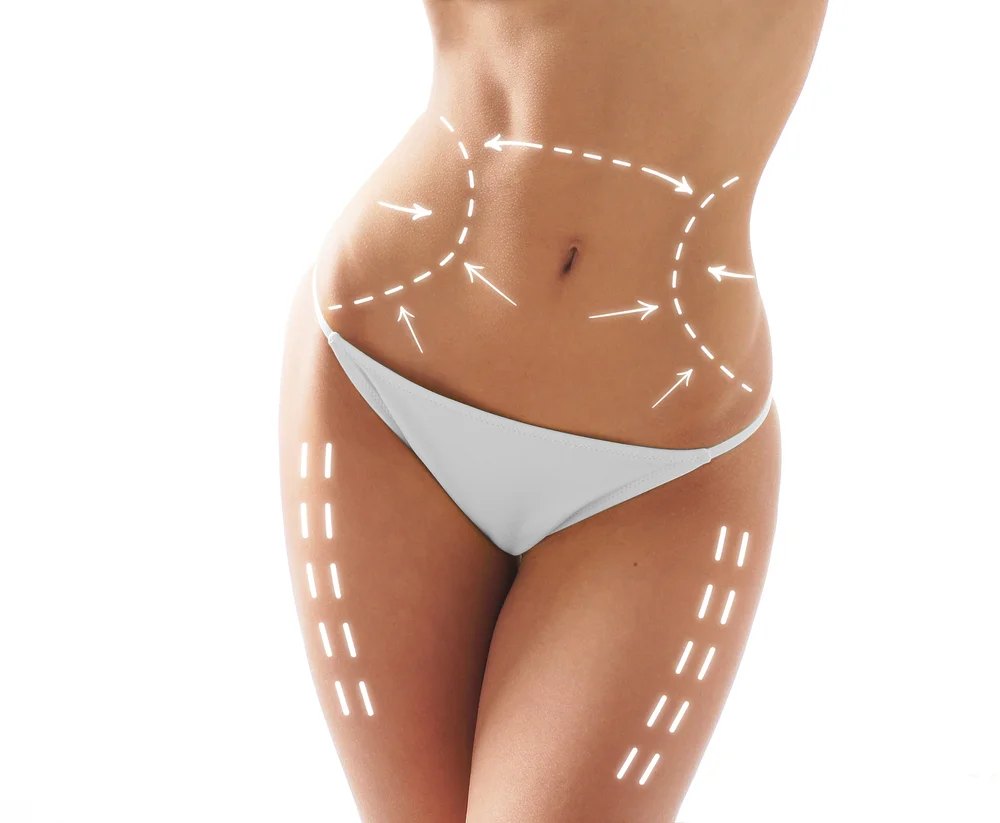 Freeze Off Your Fat With CoolSculpting