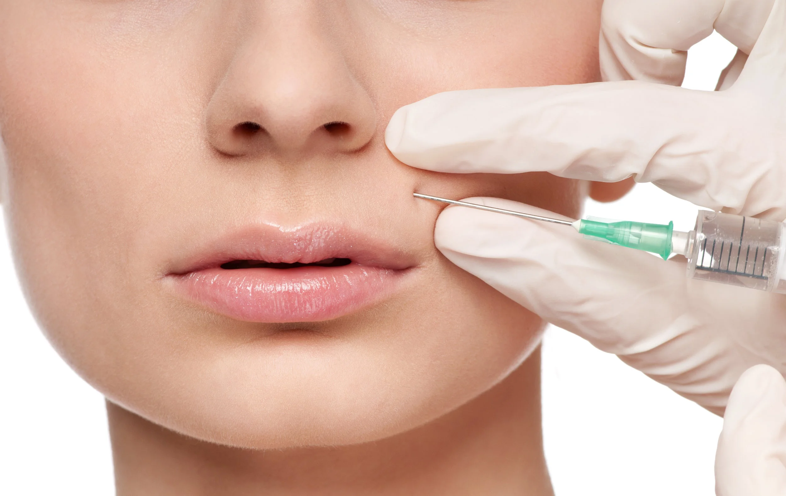 Unhappy With Your Filler Results? Don't Worry, They Aren't Permanent