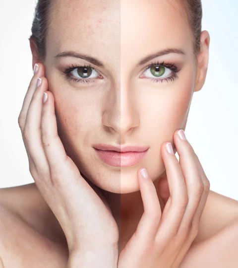 Turn Back Time With a Photofacial