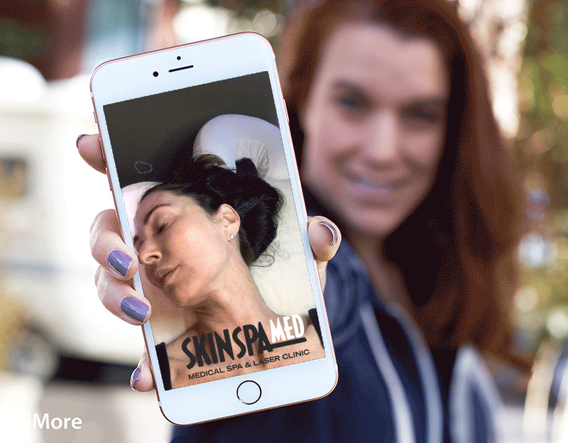 Skinfinity RF: The Cure Wrinkles, Fine Lines, Loose Skin and More