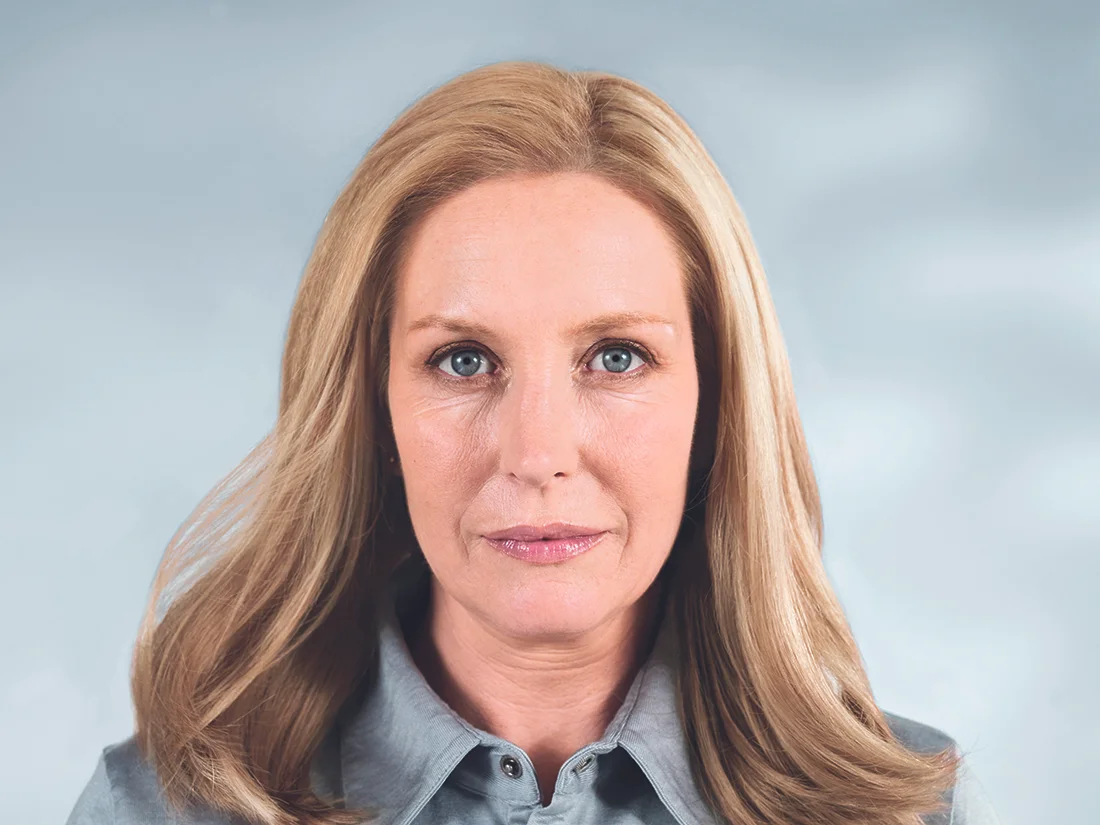 Understanding Sculptra Aesthetic 