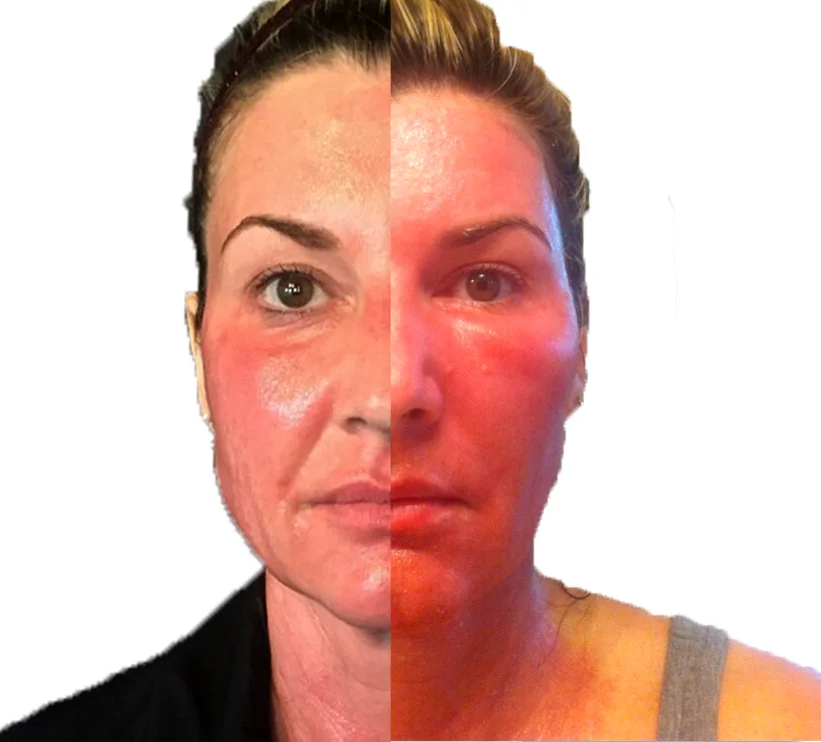 DOT CO2 With, and Without PRP