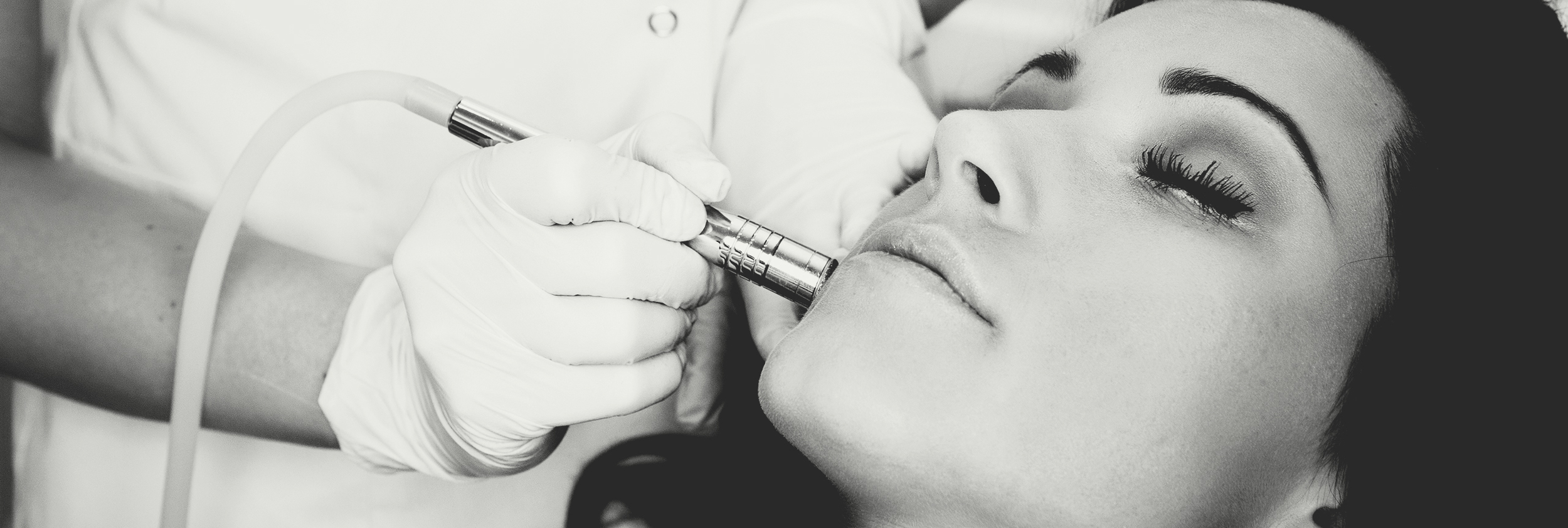 Reduce Wrinkles and Fine Lines with Micro-Needling