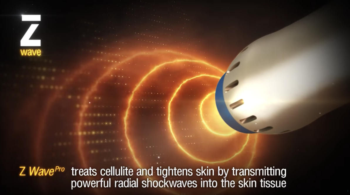 Rid Yourself of Cellulite With ZWave
