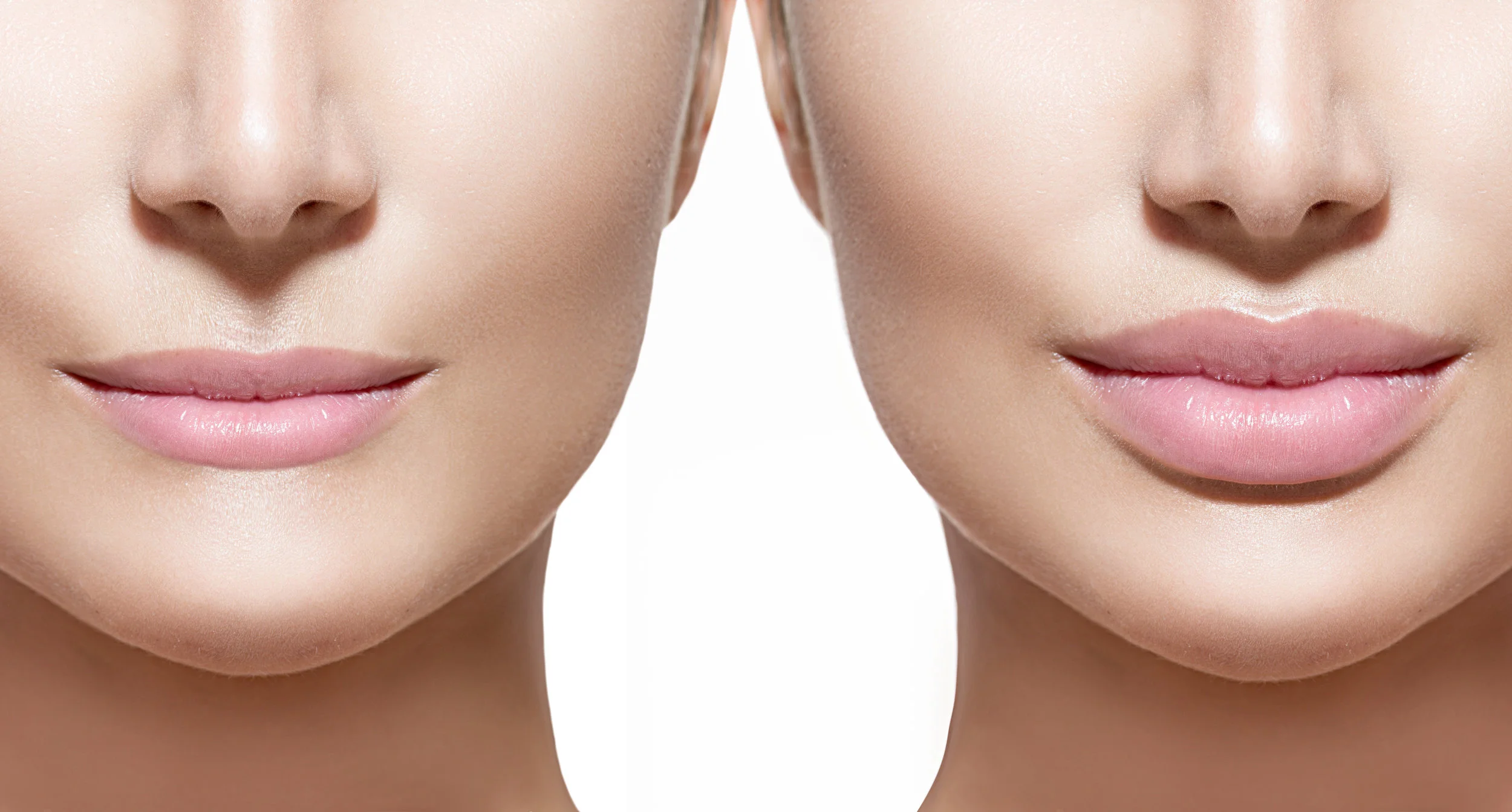 Juvederm Filler: What to Expect