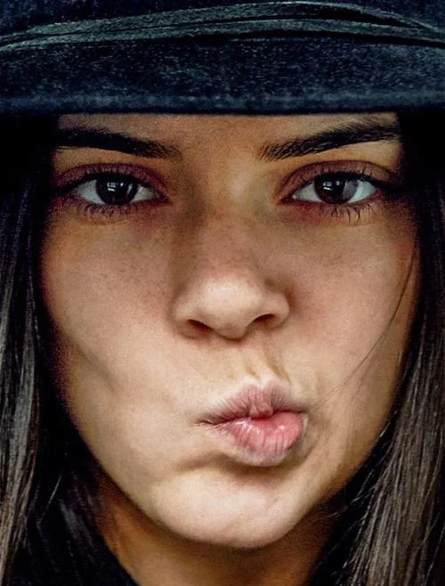 What We Can Learn from Kendall Jenner's Acne Struggle
