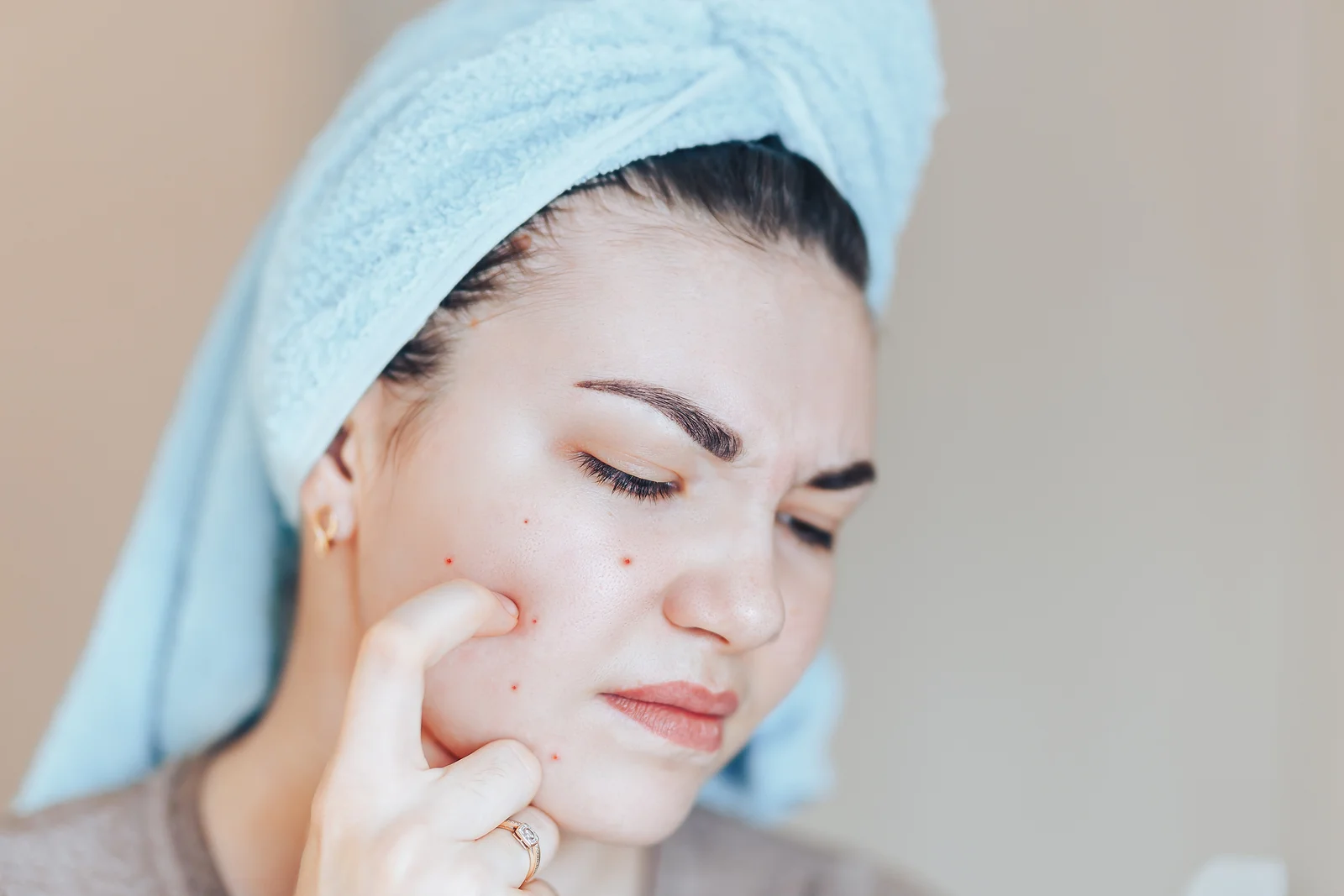 How A Chronic Skin-Picker Created a Sane, Affordable Skin Care Routine