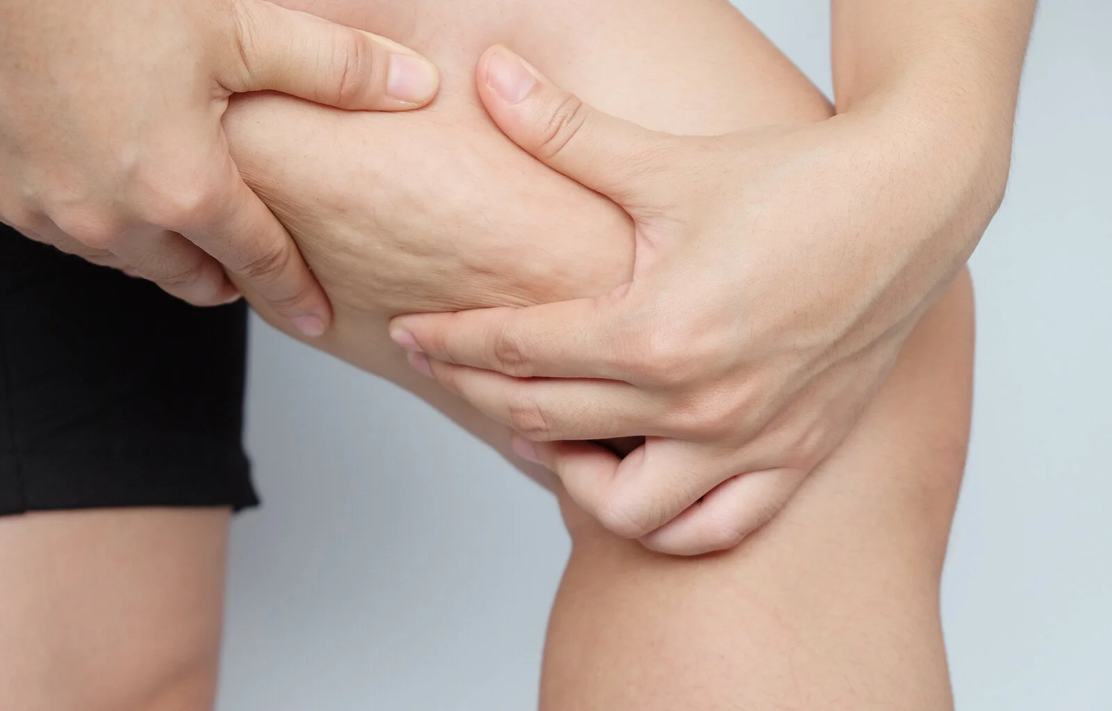6 Cellulite Myths You Don't Want to Fall For