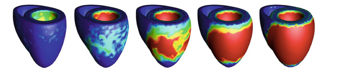 A model of left ventricular concentric growth in response to systemic hypertension (predicted wall thickening between 1-blue and 2-red fold).