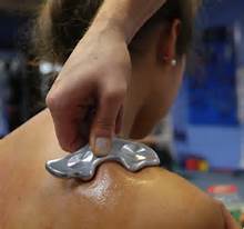 Just a little work goes a long way with IASTM work.