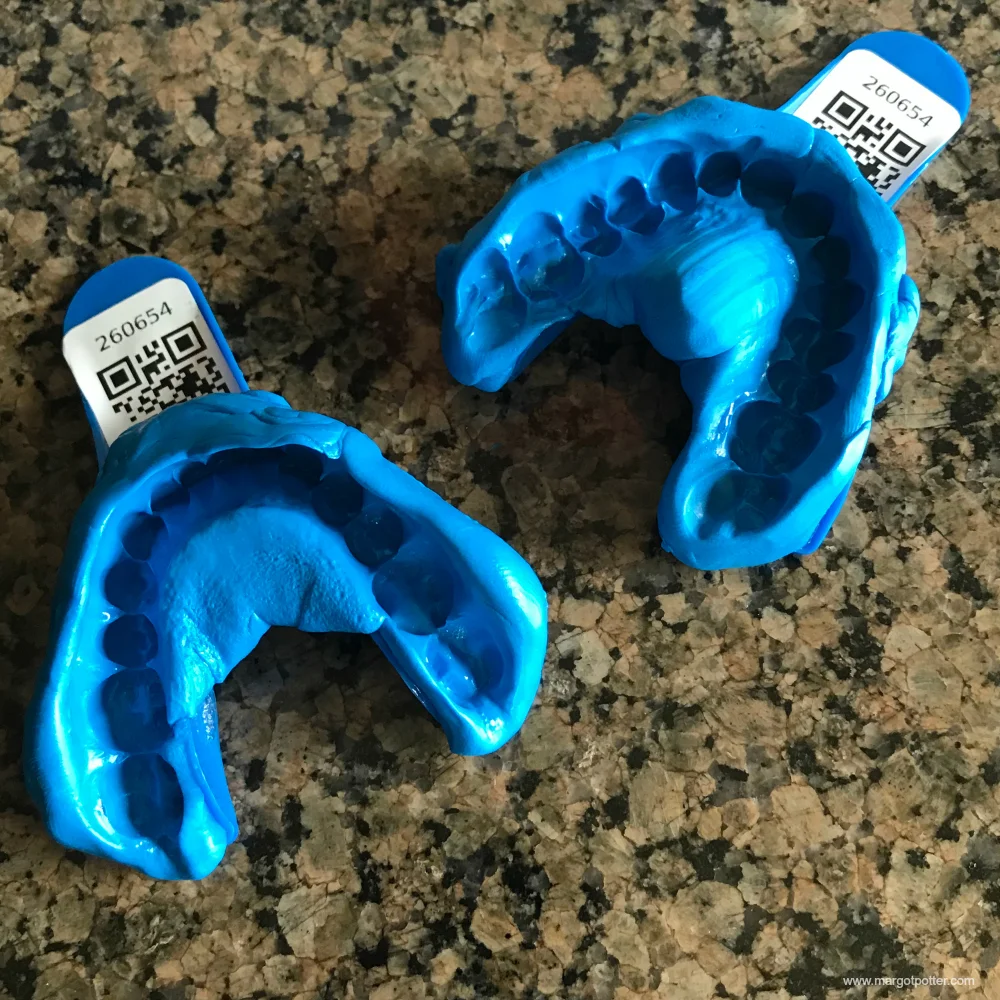 My tooth molds ready to ship back to Smile Brilliant!