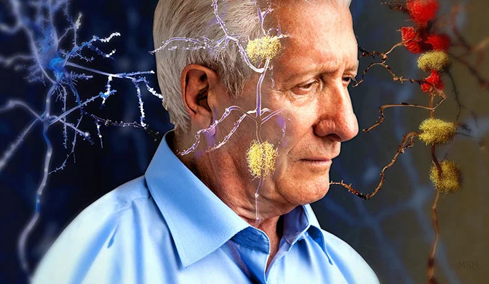 Newly published research led by the Yale School of Public Health demonstrates that individuals who hold negative beliefs about aging are more likely to have brain changes associated with Alzheimer’s disease.