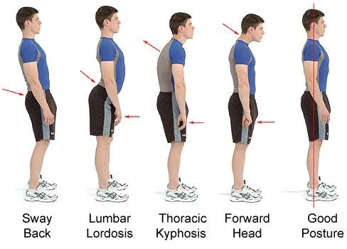 Posture.jpg