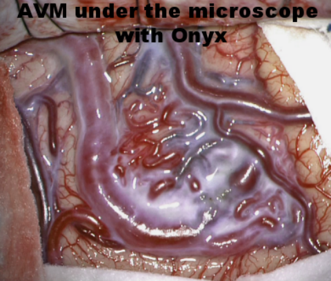 AVM-onyx.png