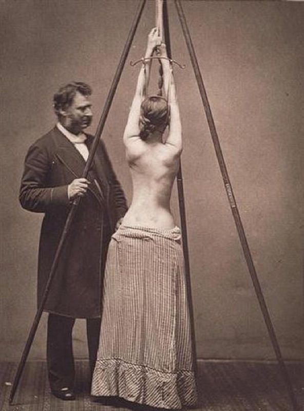 "Zdravljenje" histerije. Foto: Medical History