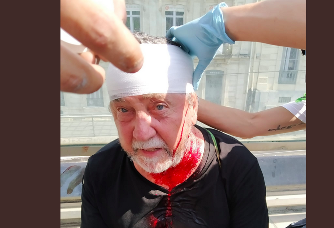 Ena izmet številnih starejših žrtev policijskega nasilja. Twitter via @O_Rich_ (Ollie Richardson)