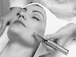 Micro-what now? What is Microneedling?